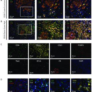 Multispectral Images Of CD20 Cluster Score Low And High Tumors A B