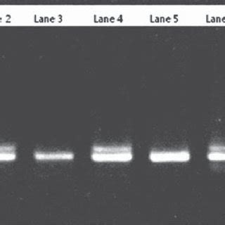 A Gel Electrophoresis Of Sex Specific PCR Products For Sex