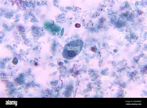 Magnified 1125x This Photomicrograph Revealed The Presence Of A Parasitic Trophozoite Entamoeba