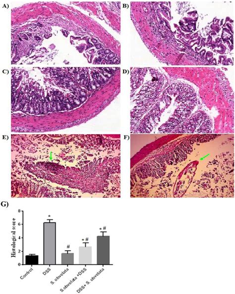 Histopathological Results Of Colon Sections With Hande Stain In Different Download Scientific