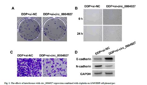 Effect And Association Of Circ And Microrna On Lung Cancer