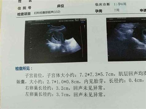 孕囊大小与孕周对照表公式 准确看出胎儿发育情况 姐妹邦