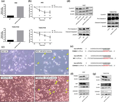 Mir 451a Inhibits Cell Proliferation And Induces Apoptosis In