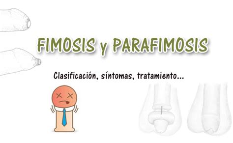 Como Saber Si Tienes Fimosis O Frenillo Corto De Forma Facil Otosection