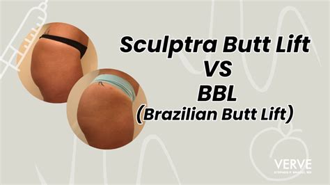 Sculptra Butt Injections VS BBL Brazilian Butt Lift Choosing