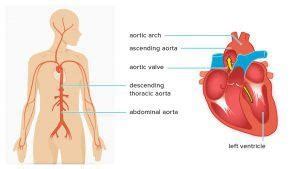 Ascending Aorta & Arch Surgery Hospital & Doctors in India - HBG ...