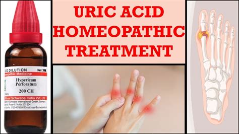 Gout And Uric Acid Symptoms Uric Acid Homeopathic Treatment Gathiya