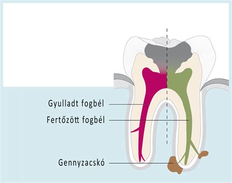 A Fogf J S Okai S T Pusai Dentabo Fogorvosi Rendel