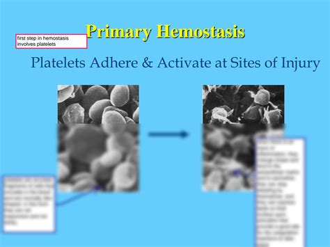 SOLUTION: Mechanism of hemostasis - Studypool