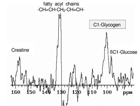 Example For A Typical 13 C Spectrum At The C1 Glycogen Position In Vivo