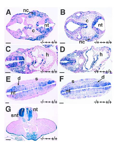 Histological Analysis Of Whole Mount Galactosidase Stained Chimeric