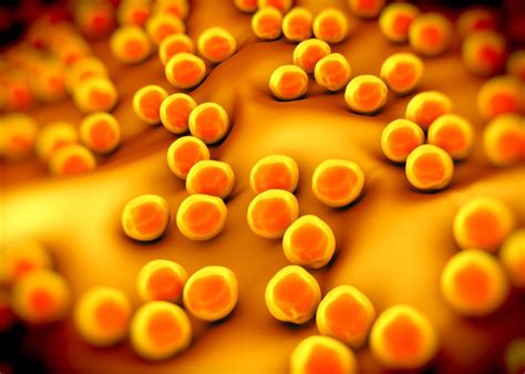 Mrsa Mrsa Symptoms Contagious Causes And Treatments Please Mrsa Is A Staph Germ