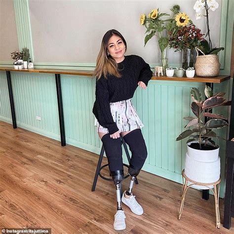 Woman Who Lost Both Her Legs To Meningococcal Creates Her Own Fashion