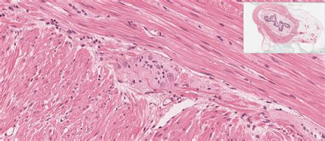 Small and Large Intestine | histology