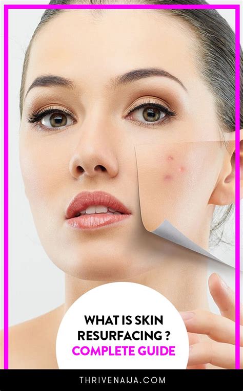 What Is Skin Resurfacing Complete Guide Thrivenaija