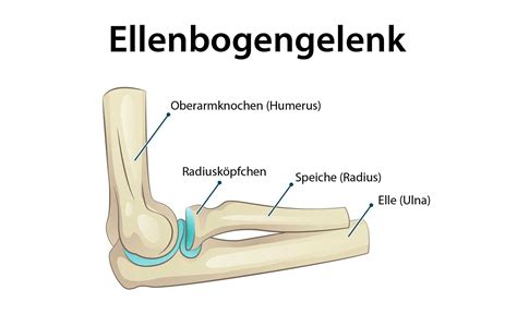 Was ist eine Radiusköpfchenfraktur und wie wird behandelt