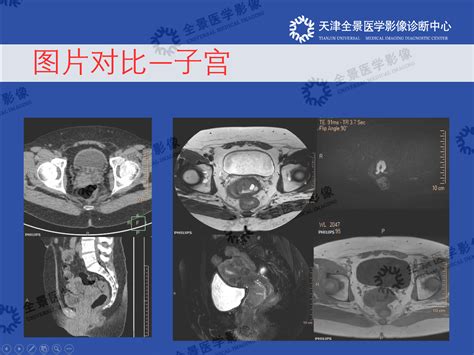 第三十八期：天津中心《盆腔专场》影像技术评审会全景医学影像