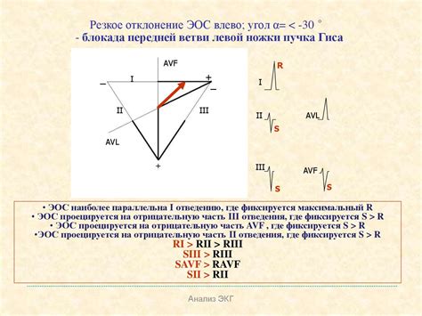 Нормальная ЭКГ - online presentation