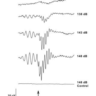 Auditory Brainstem Response To A 600 Hz Tone Burst For Pomacentrus