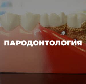 Понятная пародонтология