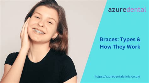 Braces Types How They Work Azure Dental Clinic