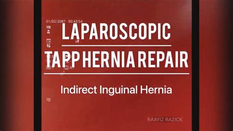 Indirect Inguinal Hernia Laparoscopic Tapp Hernia Repair Youtube