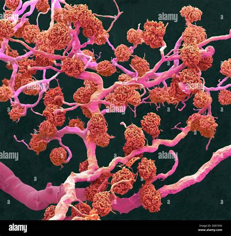 Kidney Glomeruli Coloured Scanning Electron Micrograph SEM Of A