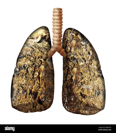 Pulmones De Fumadores Fotograf As E Im Genes De Alta Resoluci N Alamy