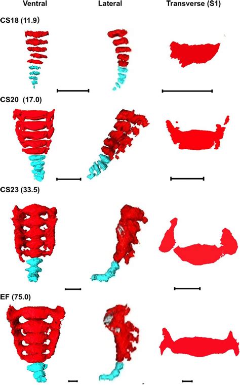 Cartilage Formation In The Sacrum And Coccyx Three D Reconstruction Of