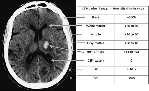 รู้จักกับ Dicom File Image และ Ct Image By Parin Kittipongdaja Medium