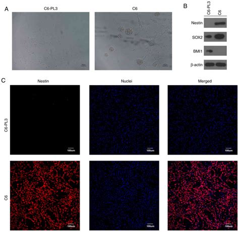 Acquisition Of Temozolomide Resistance By The Rat C6 Glioma Cell Line