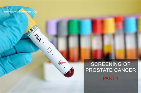 Screening Of Prostate Cancer Part 1