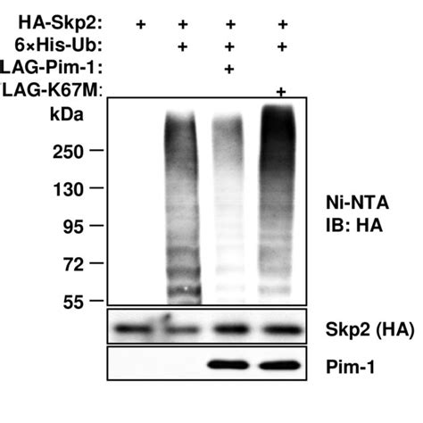 Hek293t Cells Were Transfected With The Indicated Plasmids Treated