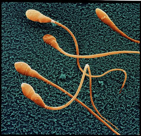 Sperm Cell Under Electron Microscope