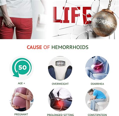 Buy Reejoys Hemorrhoid Cream Hemorrhoid Treatment Hemorrhoid