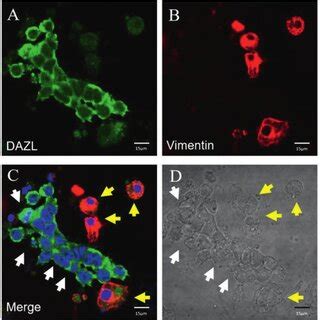 DAZL And Vimentin Immunocytochemistry In A DAZL Expression Is