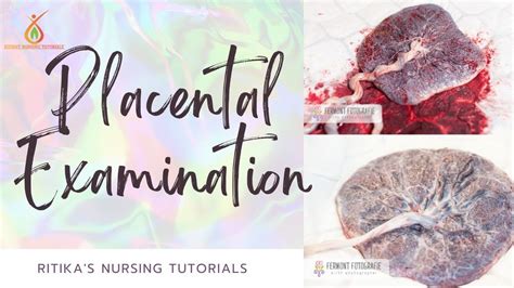 Placental Examination Formation Purpose Articles Steps