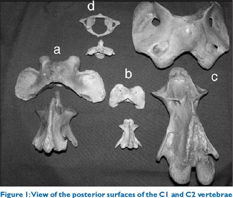 Figure From Comparative Quantitative Analysis Of Osseous Anatomy Of