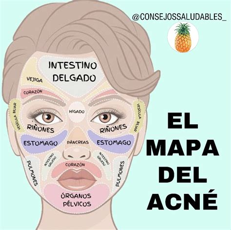 El Mapa Del Acn Produtos Para Acne Dicas De Maquiagem Melhores