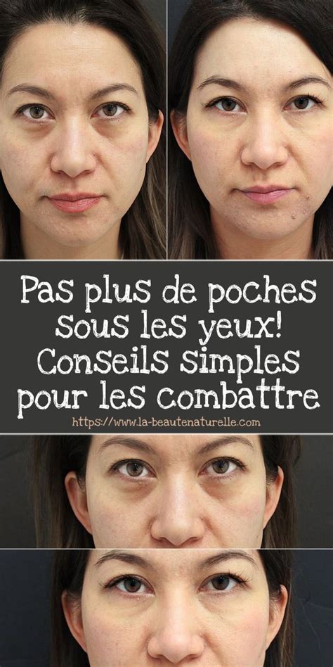 Pas Plus De Poches Sous Les Yeux Conseils Simples Pour Les Combattre