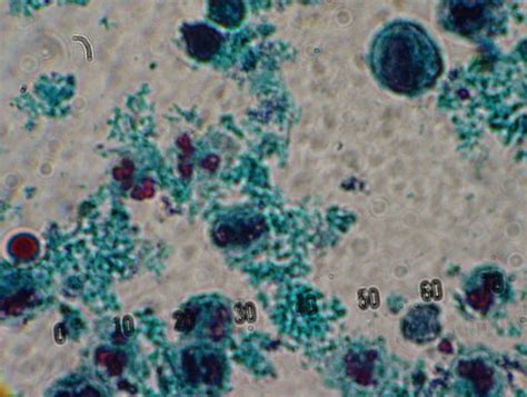 Fecal Wbc Prep With Stain