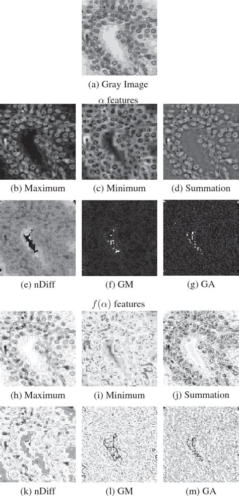 Figure 1 From Multifractal Feature Descriptor For Diagnosing Liver And