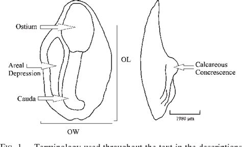 Figure 1 From Otolith Morphology And Body Size Relationships For Juvenile Sciaenidae In The Río