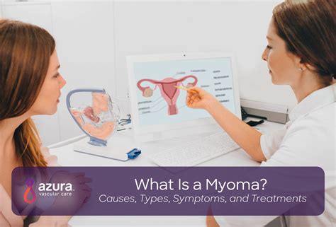 Myoma, The Causes, Types, Symptoms and Treatments