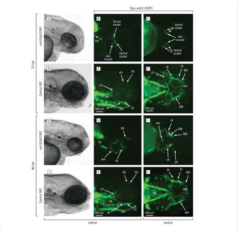 Neural Crest Cell Migration Is Necessary For Extraocular Muscle EOM