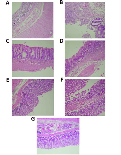 The Histologic Section Of Colon View Hande ×100 A Normal Control Download Scientific Diagram