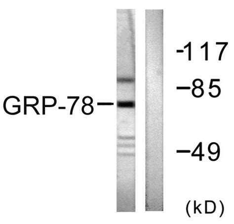 Anti HSPA5 GRP78 BiP Antibody Rabbit Anti Human Polyclonal LSBio