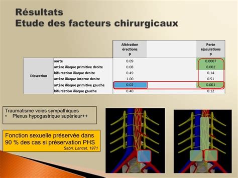 Urofrance Évaluation prospective des dysfonctions sexuelles chez les