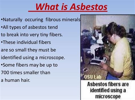 What Is Asbestosis Exposure Symptoms Prognosis Cancer Treatment