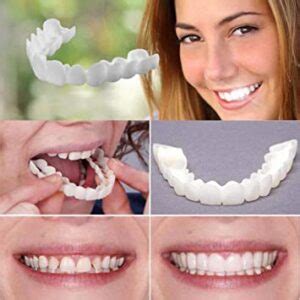 Dónde Comprar un Snap On Smile Blog Dental Irriak